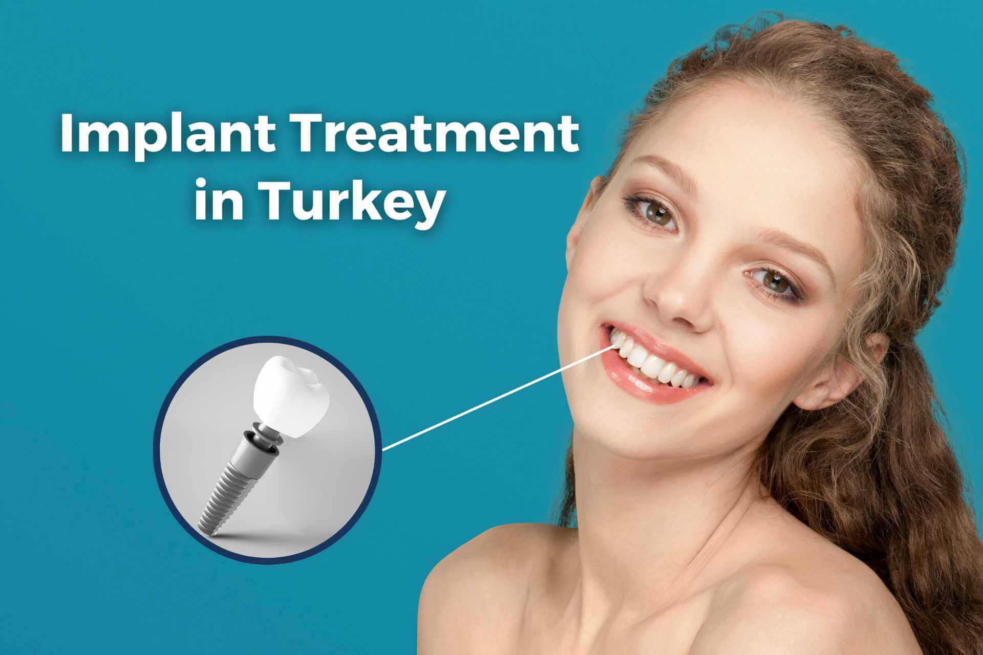 woman implant treatment smile